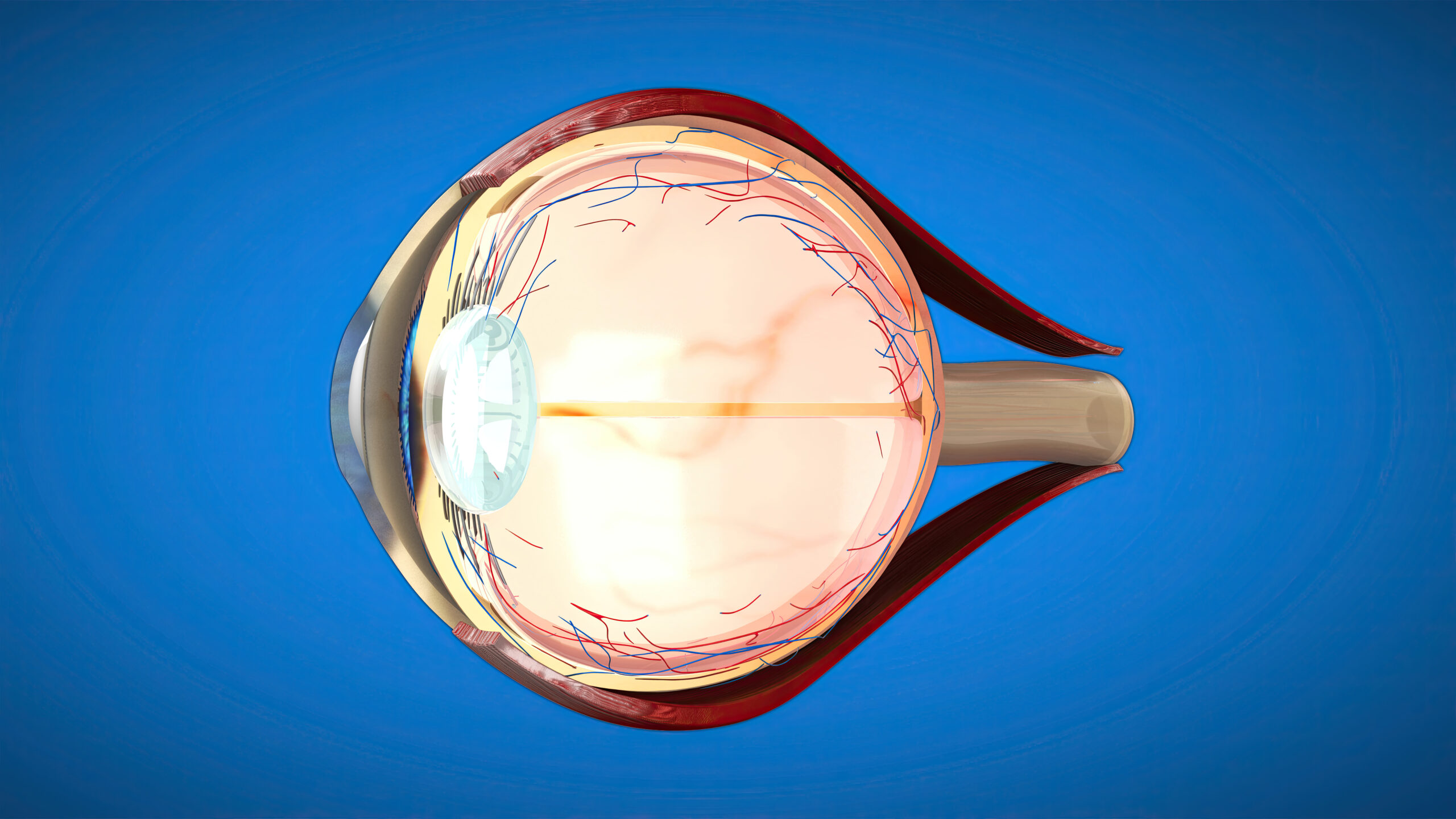 Vitreo-retina and Uvea
